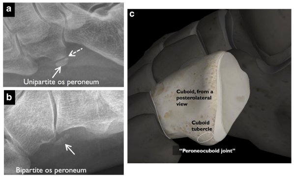 Os peroneum и peroneocuboid joint
