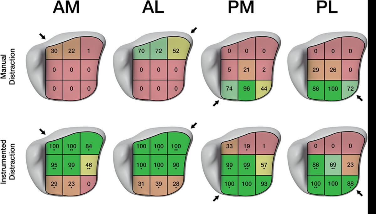 Рис. 21. Визуализация пилона при различных доступах