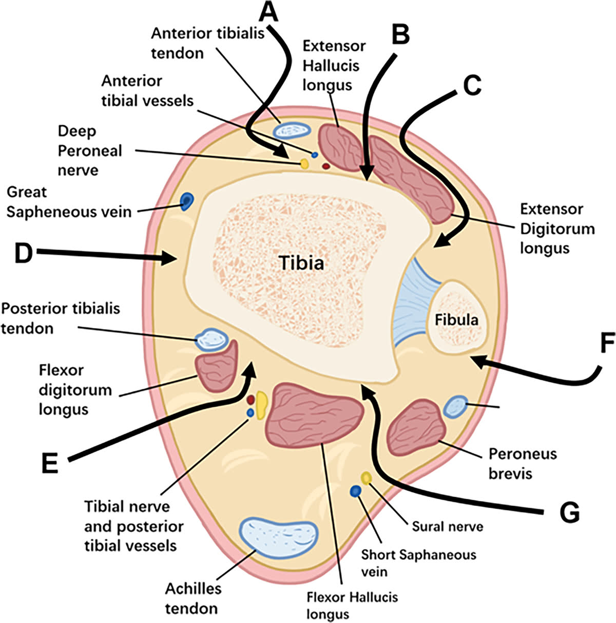 Рис. 23. Хирургические доступы к дистальному отделу большеберцовой кости