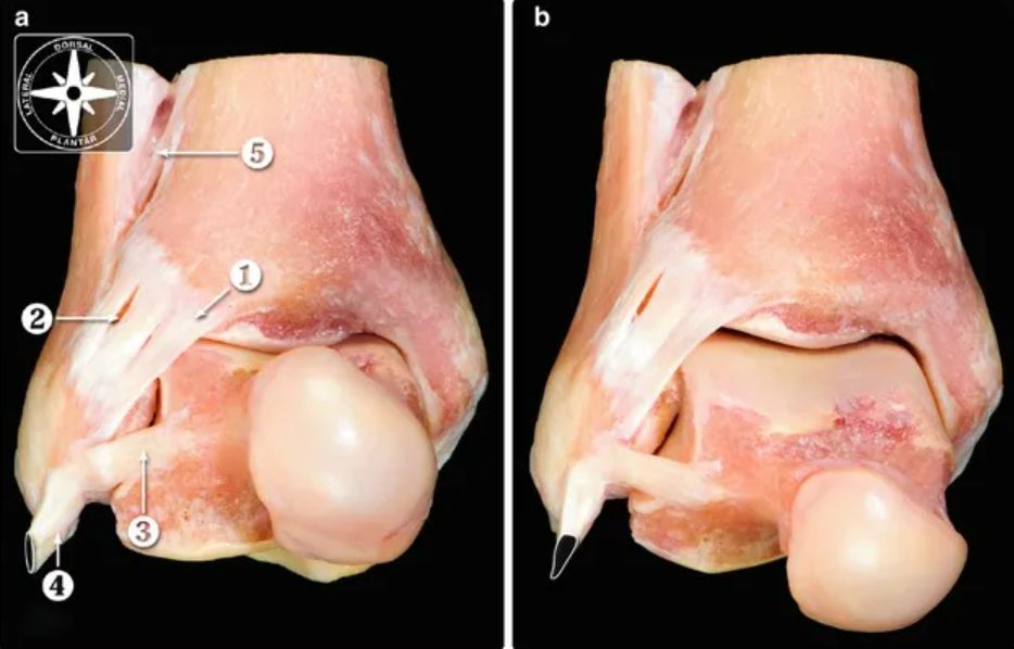 Рис. 1. Анатомия голеностопного сустава (вид спереди)