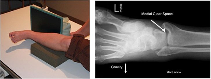 Рис. 15. Гравитационный стресс-тест (gravity stress view)