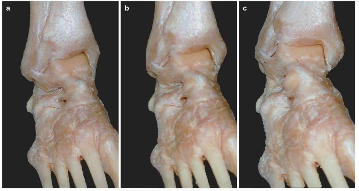 Ротационная стабильность голеностопного сустава