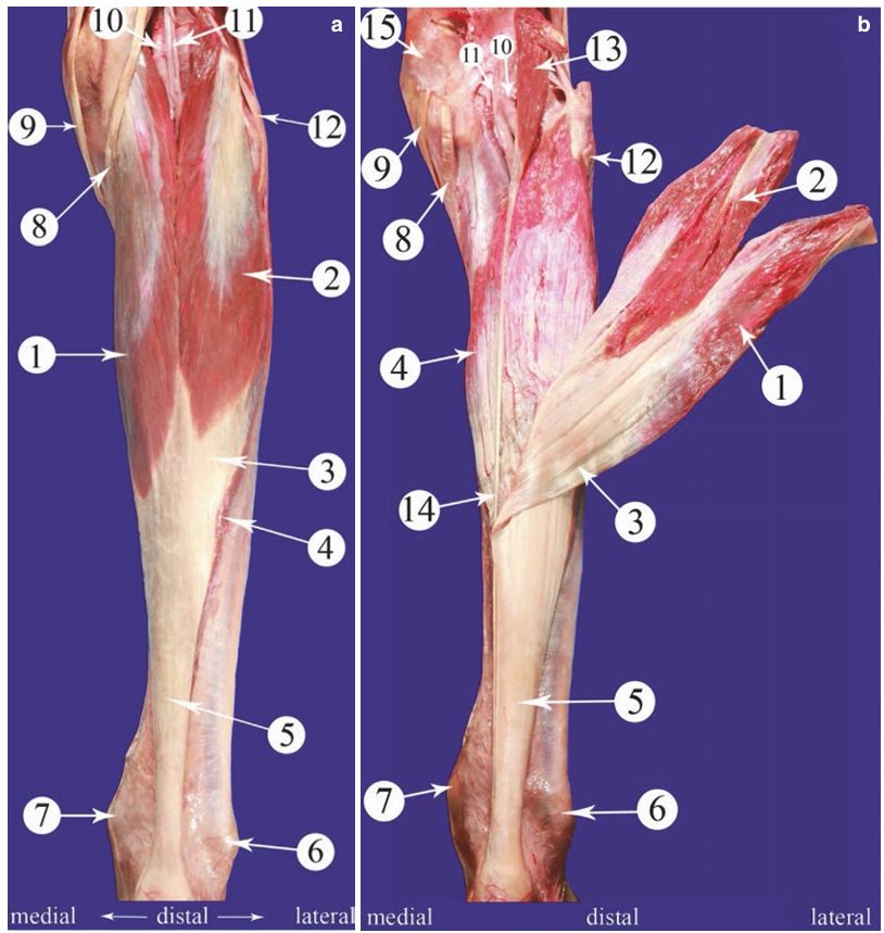 Рис. 2. Анатомия ахиллова сухожилия