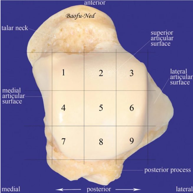 Рис. 1. Таранная кость (вид сверху). Обширная хрящевая поверхность покрывает около 60% кости