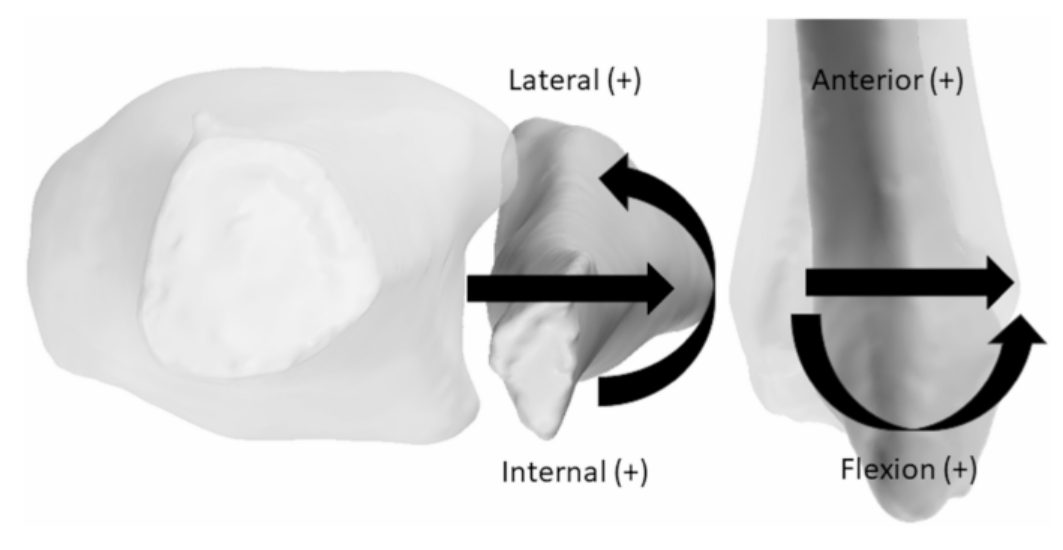 Рис. 11. Вектор движений малоберцовой кости в синдесмозе