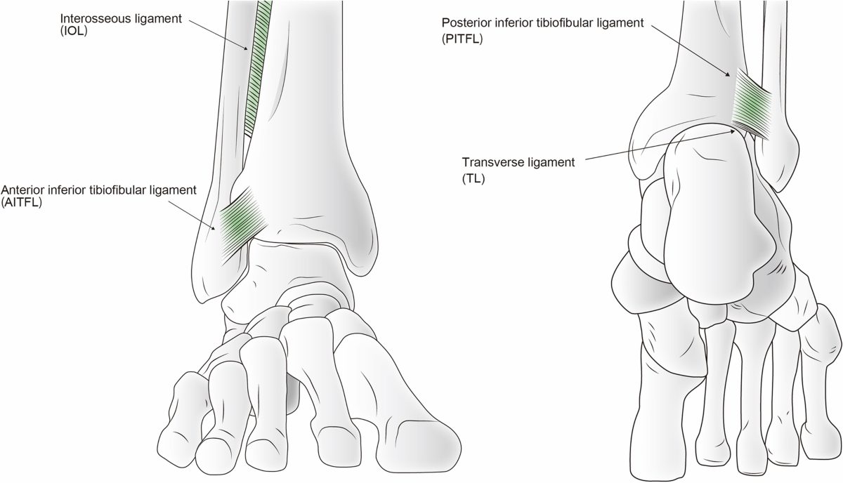 Рис. 1. Схематическое изображение синдесмоза