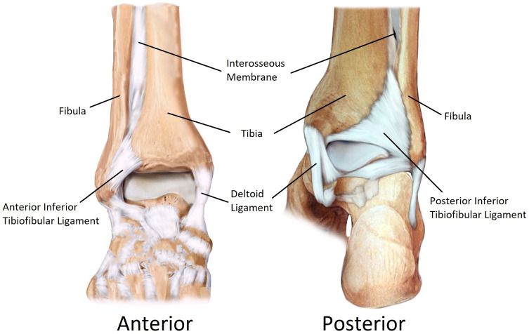 Анатомия межберцового синдесмоза — четыре связки