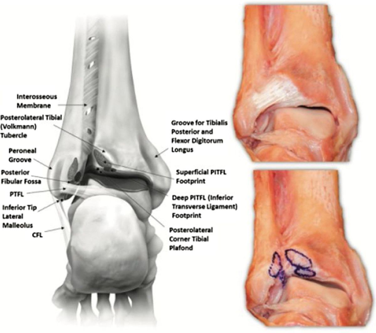 ЗНМБС — задний вид, 3D-модель и кадаверный препарат
